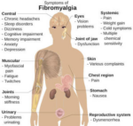 What is Fibromyalgia and The List of Fibromyaldia Medications