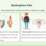 The Causes of Nociceptive Pain, How is Nociceptive Pain Treated ?