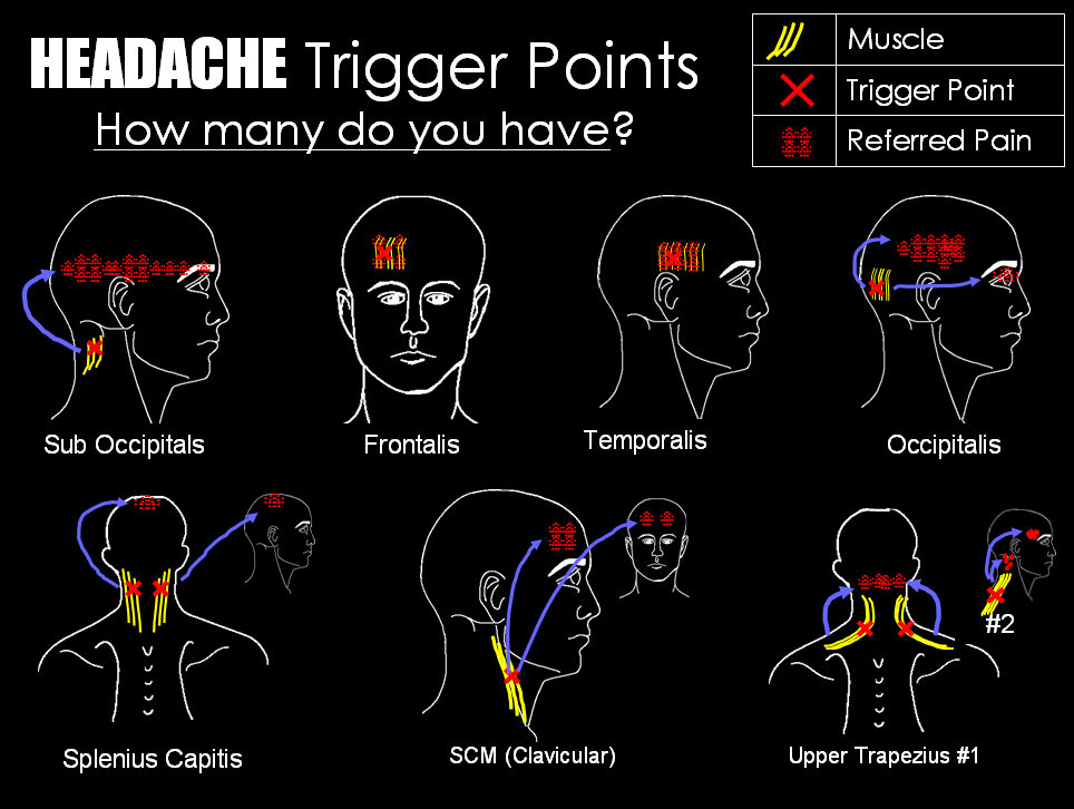 headache