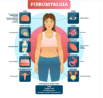 How to Treat Fibromyalgia Naturally Without Taking Medications ?