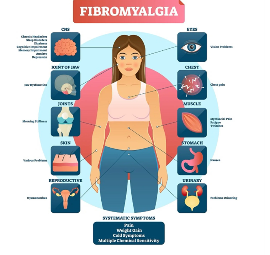 fibromyalgia