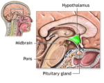 How to Treat Cluster Headaches fast