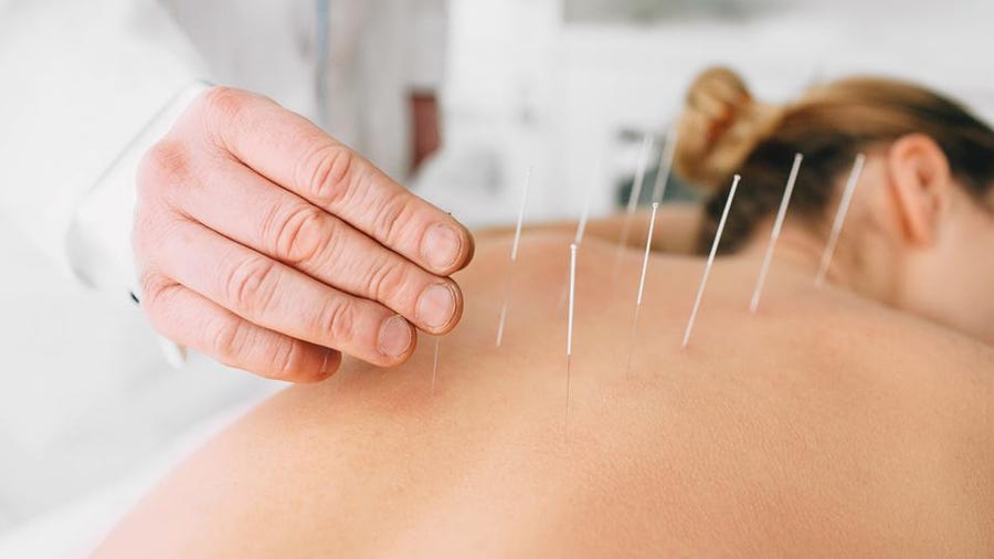 Acupuncture vs. Acupressure: What&#39;s The Difference? – Forbes Health