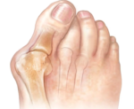 What is Toe Pain and How Many Kinds of Toe Pains Are There ?