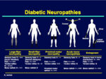 Diabetic Neuropathy