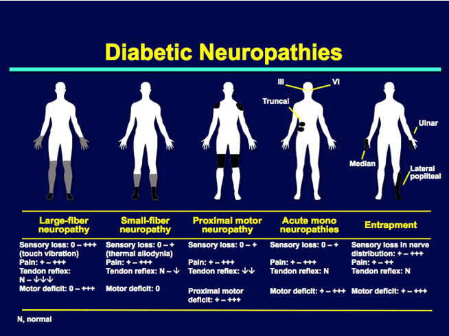 Diabetic Neuropathy