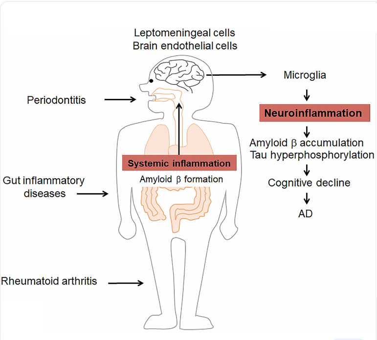 system Inflammation