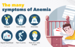 Anemia